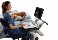  PROVIVO  STRESS ECHO - próba dobutaminowa